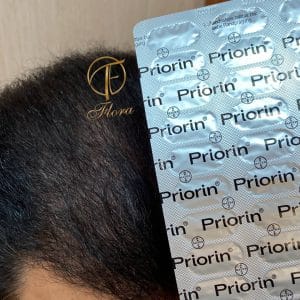 مکمل پریورین اصل