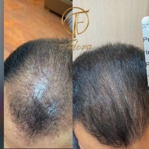 مکمل پریورین اصل آقایان